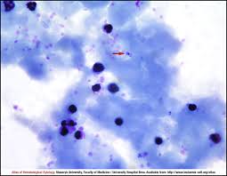 Attēlu rezultāti vaicājumam “Dianema depressum plasmodium”