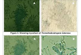 Attēlu rezultāti vaicājumam “Tremellodendropsis tuberosa”