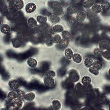 Attēlu rezultāti vaicājumam “Lycogala maculatum spores”