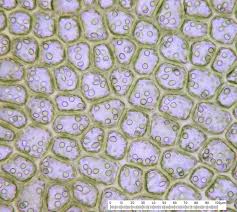 Attēlu rezultāti vaicājumam “Gymnocolea inflata”