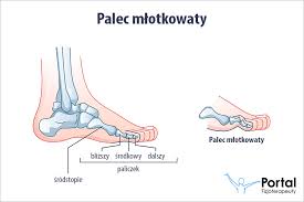 Znalezione obrazy dla zapytania palec