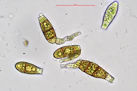 Attēlu rezultāti vaicājumam “Zygodon rupestris”