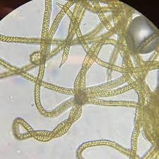 Attēlu rezultāti vaicājumam “Oligonema persimile”