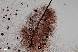 Attēlu rezultāti vaicājumam “Comatricha elegans var. microspora spores”