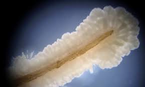 Attēlu rezultāti vaicājumam “Trichia longipalpis spores”