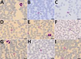 Attēlu rezultāti vaicājumam “Reticularia lobata plasmodium”