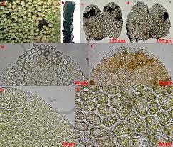 Attēlu rezultāti vaicājumam “Seligeria campylopoda sporophyte”