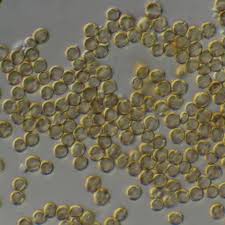 Attēlu rezultāti vaicājumam “Chaenotheca brunneola”