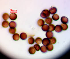 Attēlu rezultāti vaicājumam “Lycogala cf. oleocrystalliferum”