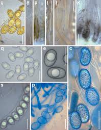Attēlu rezultāti vaicājumam “Octosporella jungermanniarum”