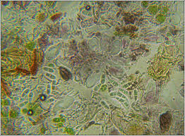 Attēlu rezultāti vaicājumam “Arthonia spadicea”