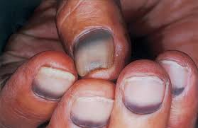Image result for lunula nail