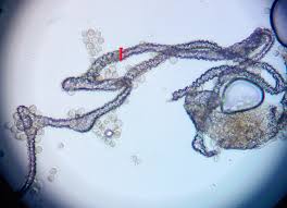 Attēlu rezultāti vaicājumam “Lycogala sphaeroconicum”