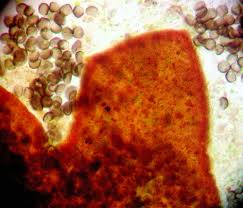 Attēlu rezultāti vaicājumam “Licea minima spores”