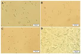 Attēlu rezultāti vaicājumam “Diderma subviridifuscum var. macrospora* macro”