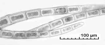 Attēlu rezultāti vaicājumam “Blepharostoma trichophyllum sporophyte”