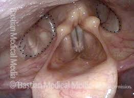 Attēlu rezultāti vaicājumam “Cribraria piriformis”