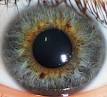 Eye color - Wikipedia, the free encyclopedia