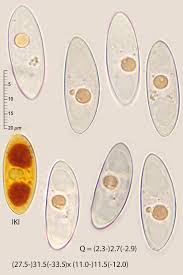 Attēlu rezultāti vaicājumam “Octosporella jungermanniarum”