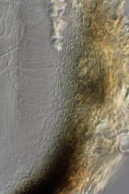 Attēlu rezultāti vaicājumam “Stictis”