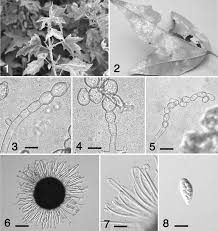 Attēlu rezultāti vaicājumam “Sawadaea tulasnei”