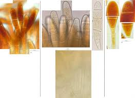 Attēlu rezultāti vaicājumam “Bactridium flavum”