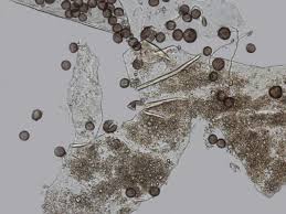 Attēlu rezultāti vaicājumam “Diderma subviridifuscum spores”