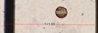 Attēlu rezultāti vaicājumam “Diderma montanum var. album macro”