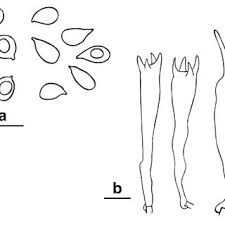 Attēlu rezultāti vaicājumam “Lamproderma gulielmae spores”