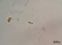 Attēlu rezultāti vaicājumam “Dacrymyces chrysospermus spores”