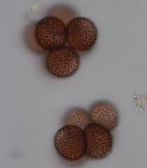 Attēlu rezultāti vaicājumam “Badhamia nitens sessile”