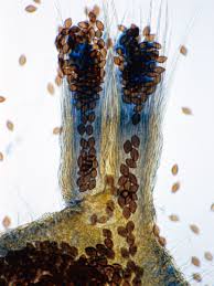 Attēlu rezultāti vaicājumam “Badhamia melanospora spores”