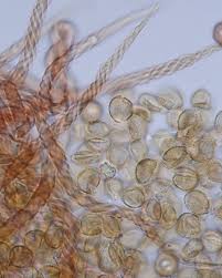 Attēlu rezultāti vaicājumam “Metatrichia floriformis stalked”