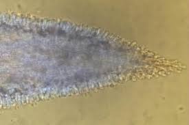 Attēlu rezultāti vaicājumam “Mucronella calva”