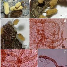Attēlu rezultāti vaicājumam “Arcyria affinis capillitium”