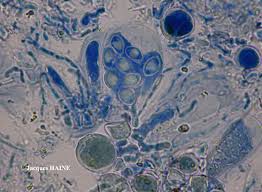 Attēlu rezultāti vaicājumam “Lecanora conizaeoides”