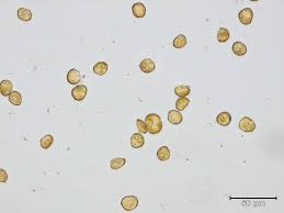 Attēlu rezultāti vaicājumam “Seligeria donniana”