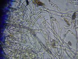 Attēlu rezultāti vaicājumam “Hyalorbilia inflatula”