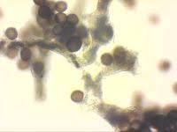 Attēlu rezultāti vaicājumam “Badhamia macrocarpa”