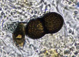 Attēlu rezultāti vaicājumam “Anaptychia ciliaris”