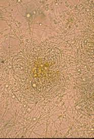 Attēlu rezultāti vaicājumam “Oligonema sp.”