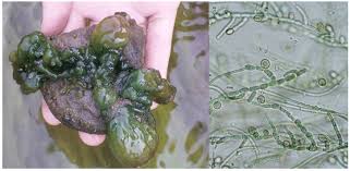 Attēlu rezultāti vaicājumam “Cyanophyta”