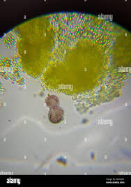 Attēlu rezultāti vaicājumam “Physarum viride var. aurantium spores”
