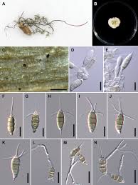 Attēlu rezultāti vaicājumam “Stemonitopsis aequalis var. microspora stalked”