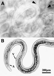 Attēlu rezultāti vaicājumam “Gulielmina vermicularis”