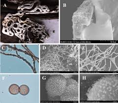 Attēlu rezultāti vaicājumam “Diderma chondrioderma spores”
