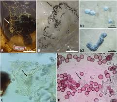 Attēlu rezultāti vaicājumam “Physarum viride var. aurantium spores”
