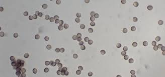 Attēlu rezultāti vaicājumam “Reticularia lycoperdon young”