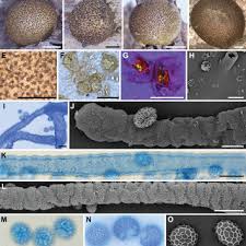 Attēlu rezultāti vaicājumam “Lycogala cf. fossiculatum macro”