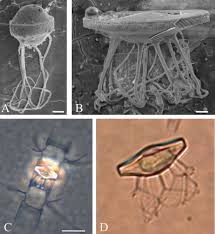 Attēlu rezultāti vaicājumam “Diachea dictyospora (syn. Craterium dictyosporum) spores”